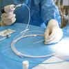 Endoscopic procedure