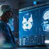 Climate change an escalating threat to brain health: World Stroke Organization