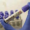 India faces no immediate public health threat from hantavirus: NIV chief