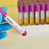 Nadda reviews dengue, malaria preparedness ahead of monsoon