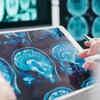 Gut microbiome changes in Parkinson's risk gene carriers could help predict disease