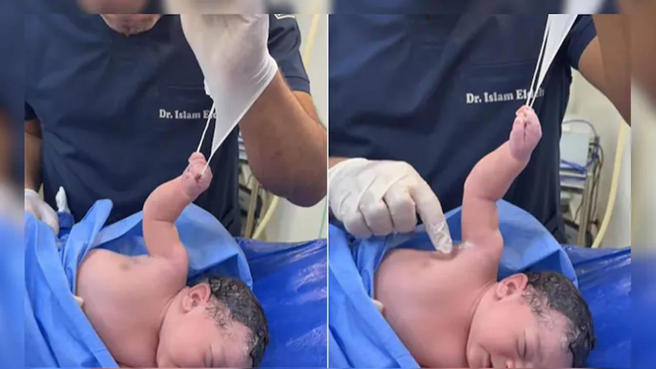 చిన్నారి బాహుబలి.. పుట్టిన వెంటనే డాక్టర్‌నే ఆపేసింది! పసికందు పట్టు చూస్తే షాక్ అవ్వాల్సిందే..