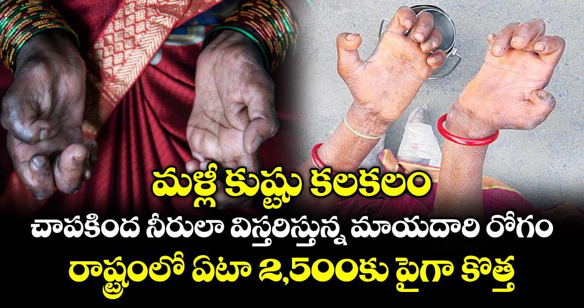 మళ్లీ కుష్టు కలకలం.. చాపకింద నీరులా విస్తరిస్తున్న మాయదారి రోగం.. రాష్ట్రంలో ఏటా 2,500కు పైగా కొత్త కేసులు