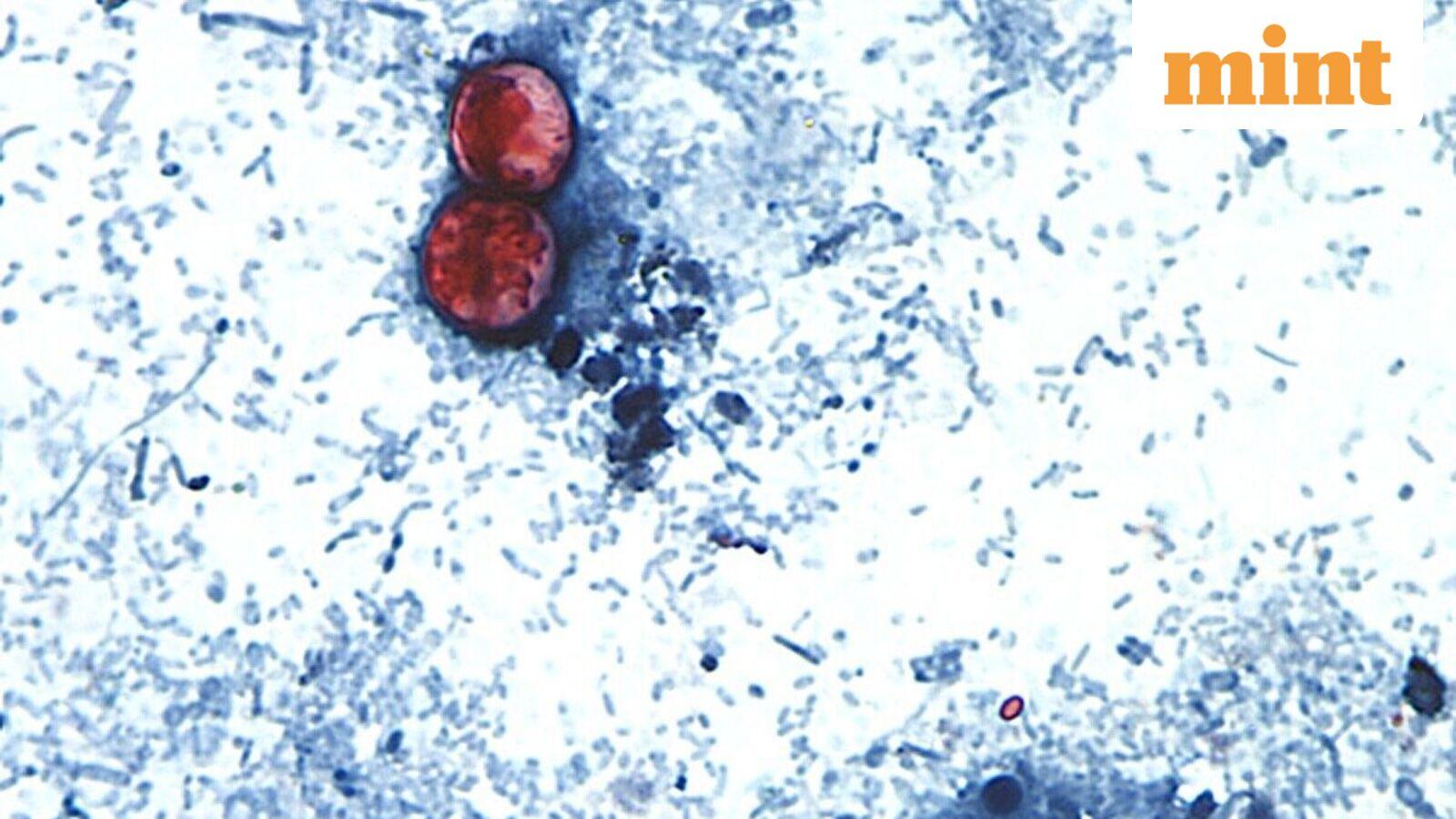 Cyclospora outbreak: Taco Bell under probe in multiple US states as Michigan links cases to salad greens